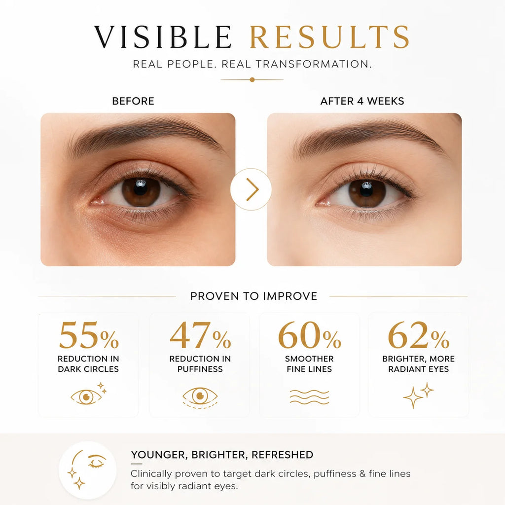 SkinSis Retinol Eye Cream