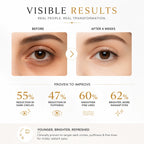 SkinSis Retinol Eye Cream