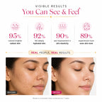 10X Alpha Arbutin Brightening Cream