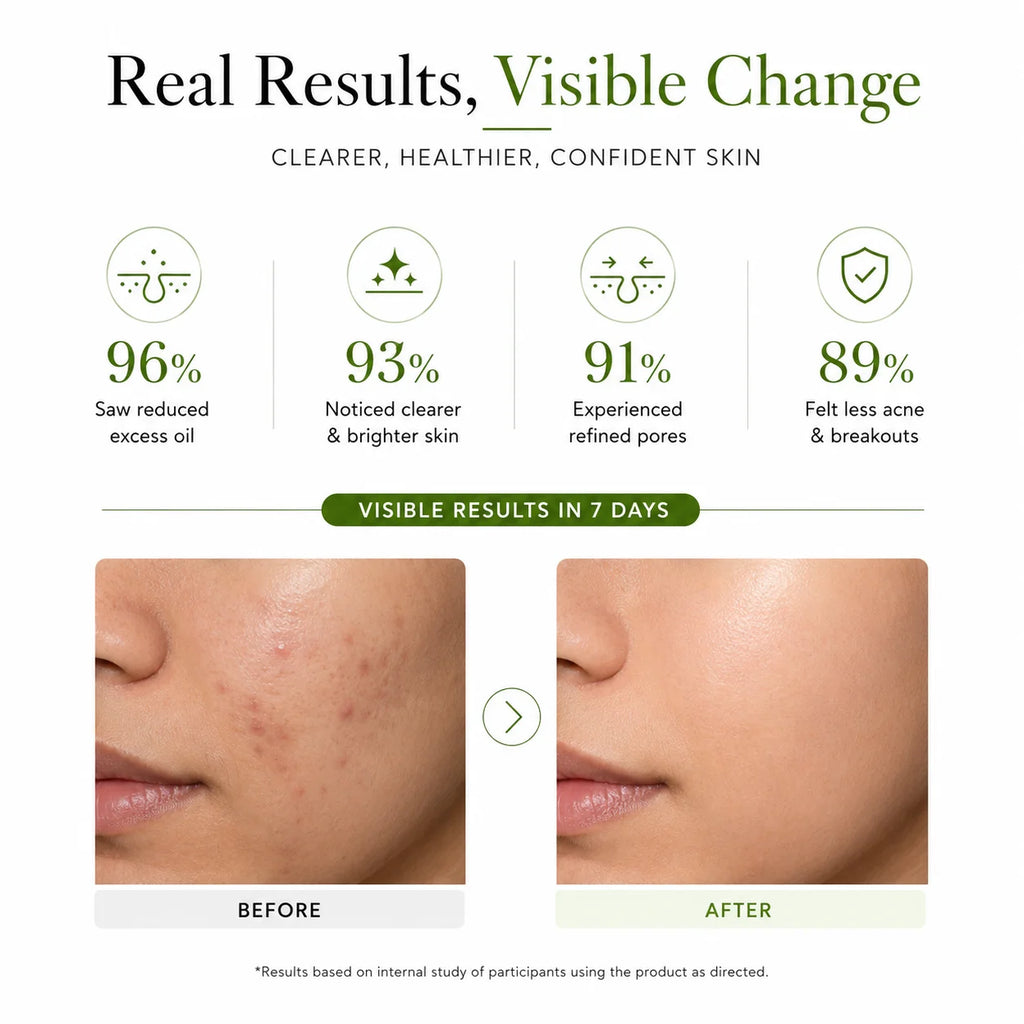 SkinSis Tea Tree Face Wash