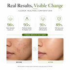 SkinSis Tea Tree Face Wash