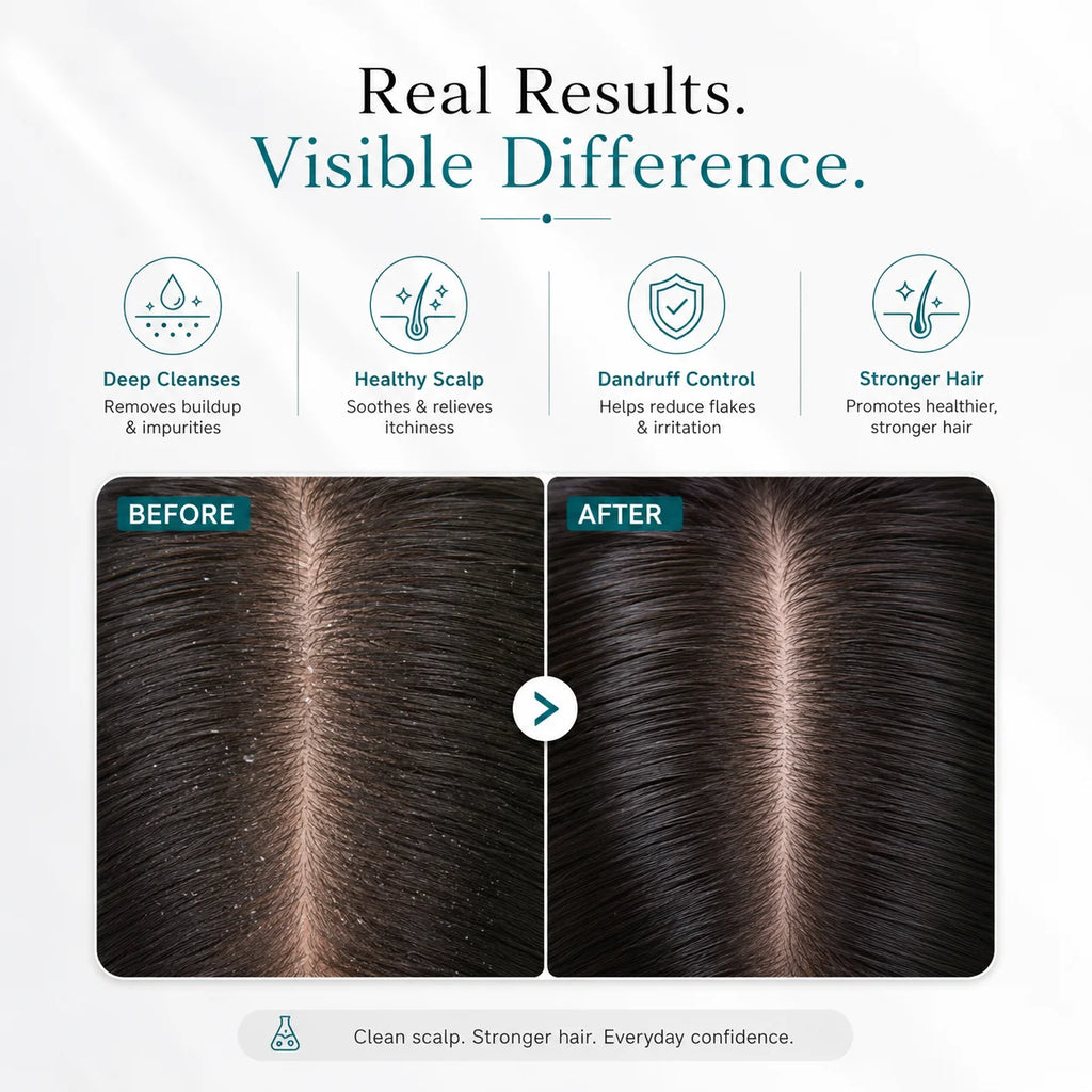 SkinSis Purifying Shampoo