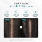 SkinSis Purifying Shampoo