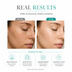 Skinsis Hyaluronic Collagen Lotion