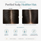 SkinSis Purifying Conditioner