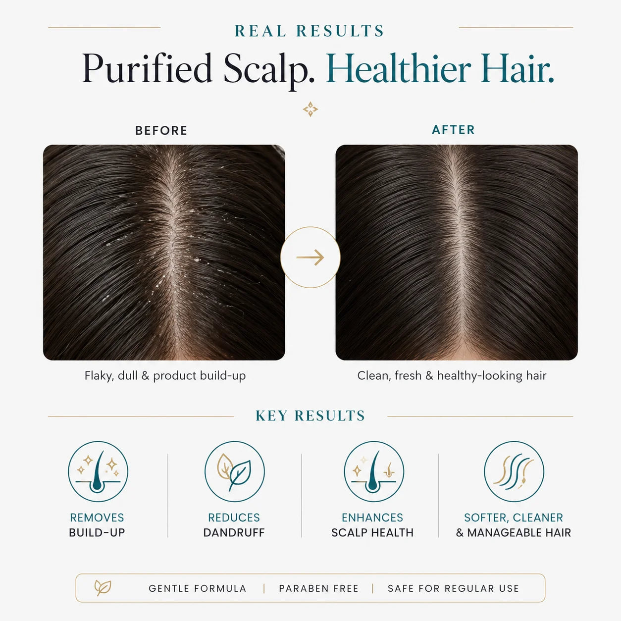 SkinSis Purifying Conditioner